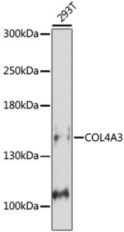 DAP Kinase 2 Rabbit anti-Human, Mouse, Rat, Polyclonal, Novus Biologicals:Antibodies:Primary